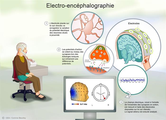 L’électro-encéphalographie