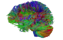 Mapping the human connectome : a challenge to the scientific community of diffusion imaging and tractography