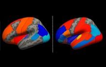 17000 brains screened for a better characterization of anatomical asymmetries
