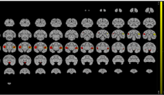 Pypreclin: a new tool for fMRI preprocessing