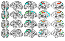 Brain sulci imaging and genetics