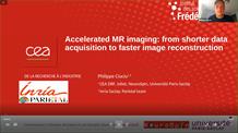 Accelerated MR Imaging: From shorter data acquisition to faster image reconstruction