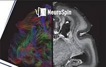 NeuroSpin one-day symposium: Past, present and future of brain imaging