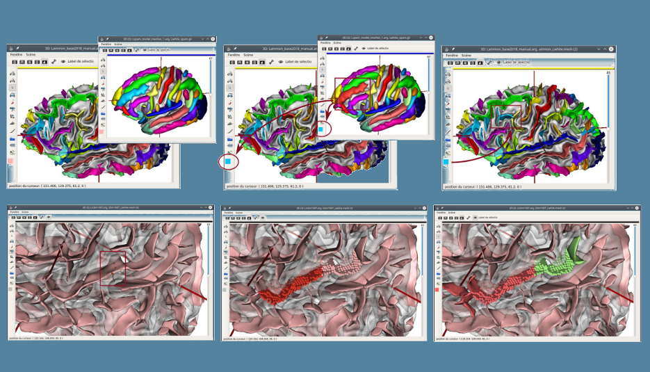 Comment faire fi de la variabilité interindividuelle pour cartographier le cerveau ?