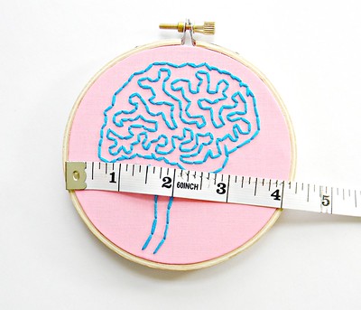 Absence d’atypies anatomiques du cervelet chez les personnes autistes