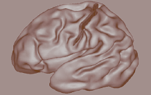 What if the shape of the early brain sulcus could predict certain pathologies? 