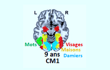 Specificity of brain circuits during reading acquisition