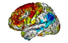 Longitudinal monitoring of tauopathy in PET imaging to better understand Alzheimer's disease