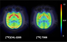 Le métabolisme du cholestérol cérébral suivi par TEP