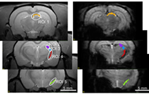 Does the propagation of action potentials in white matter require a local increase in blood flow?