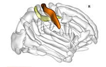 Brain imaging genomics: data integration to study normal and pathological development