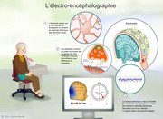 Électroencéphalographie (EEG)
