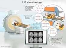 IRM anatomique